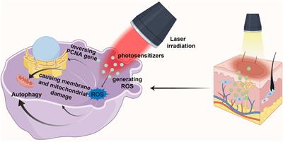 Application and progress of new technologies and new materials in the treatment of pathological scar